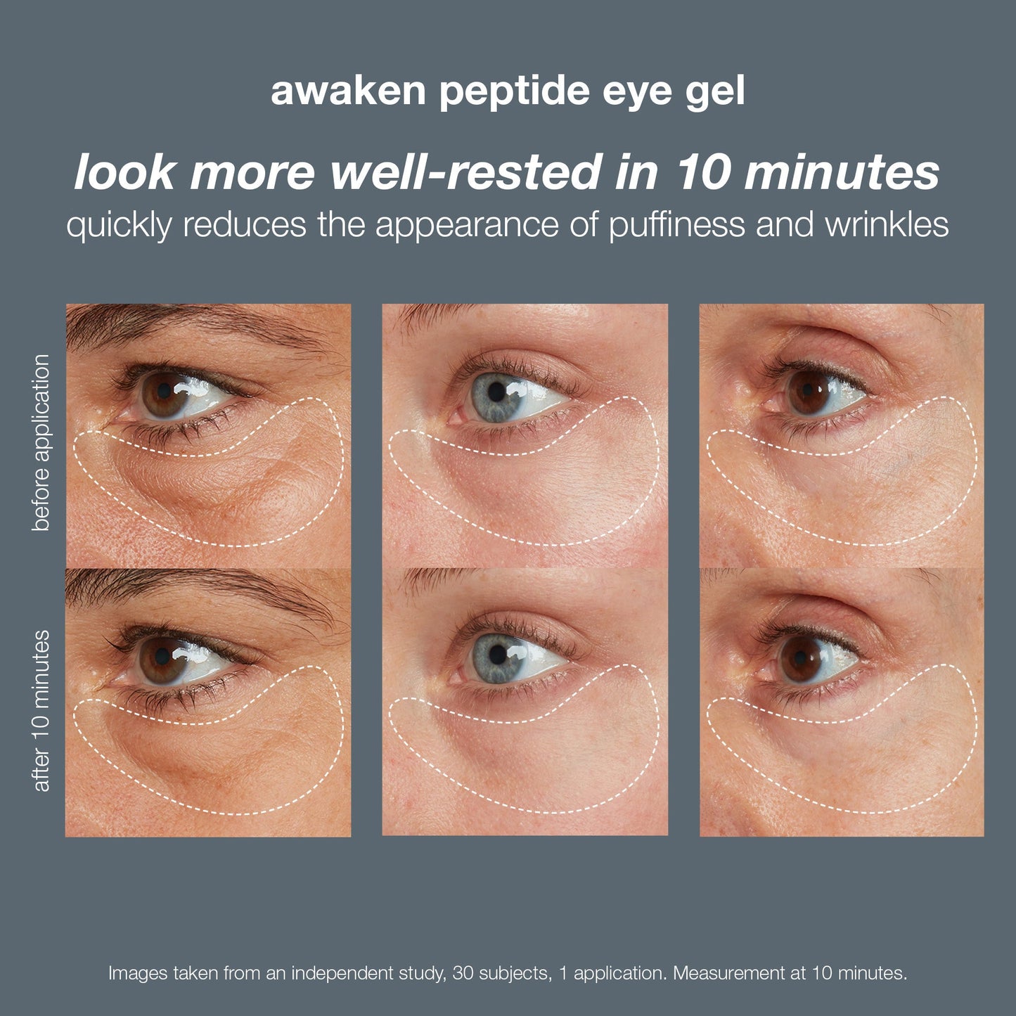 awaken peptide depuffing eye gel